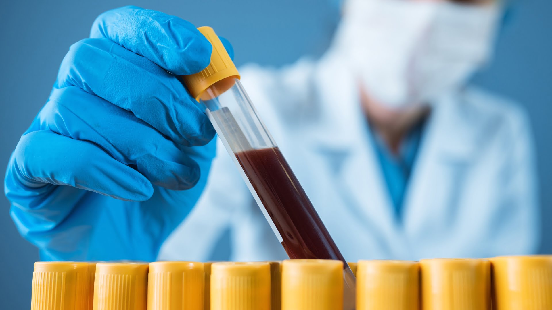 Biorezonans kan testi nedir?
